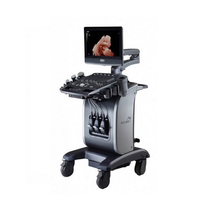 Alpinion Ultrasound Machine1