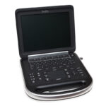 SonoScape Ultrasound Machine1