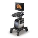 Alpinion Ultrasound Machine1