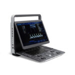 SonoScape Ultrasound Machine1