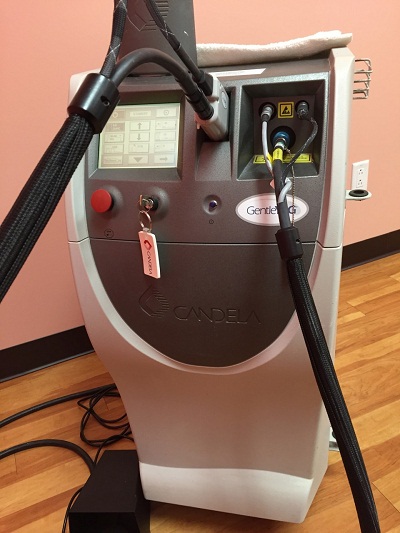 Candela-GentleYAG-Laser-Hair-Removal-Machine_2 Candela-GentleYAG-Laser-Hair-Removal-Machine_2